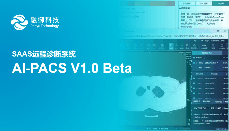 AI-PACS 产品演示